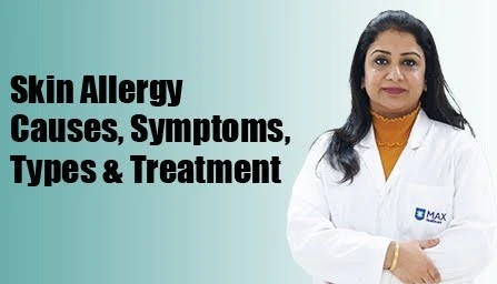 Common Dermatology Terms Explained A Simple Guide for Lucknow Patients