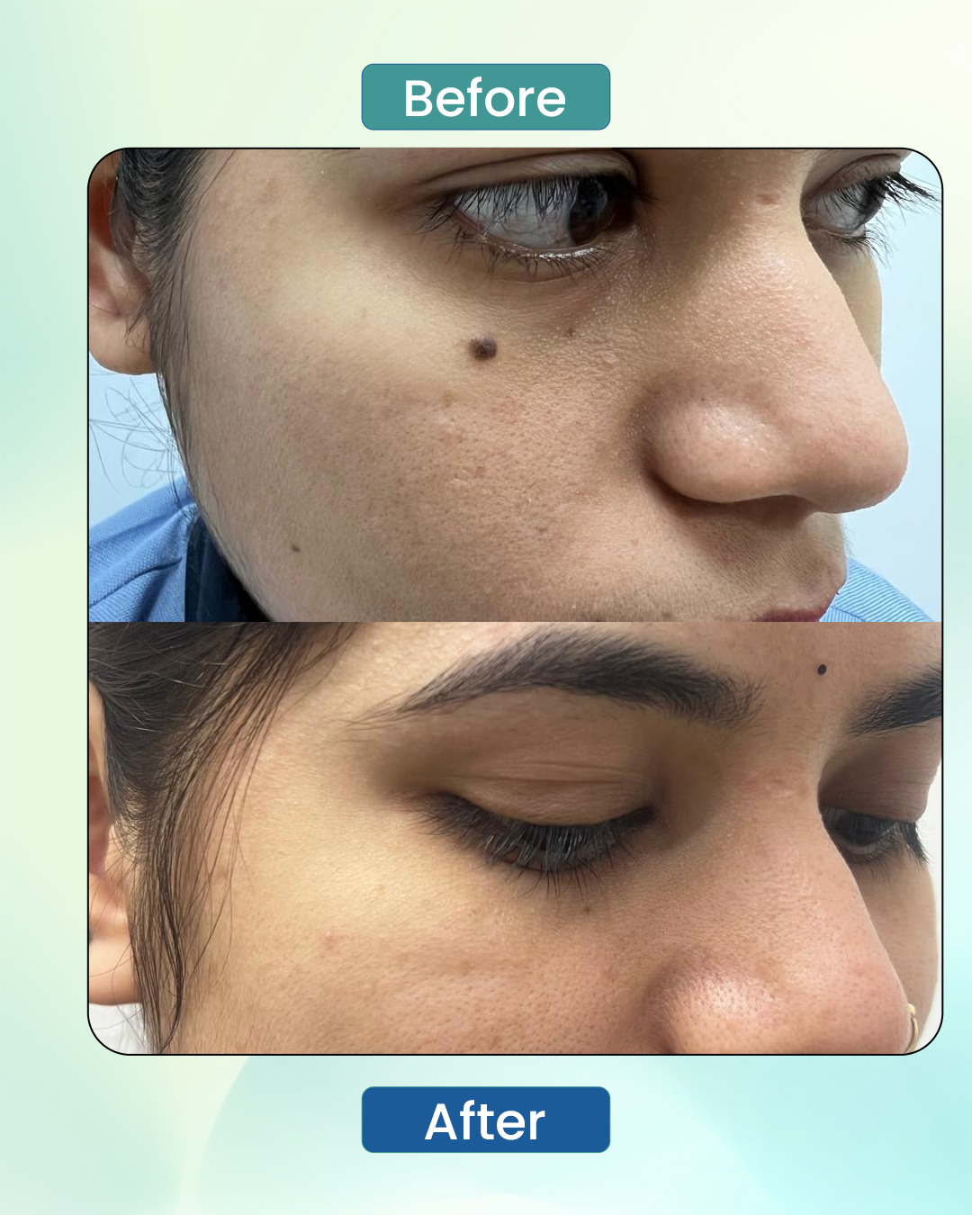 Anti ageing cosmetic care