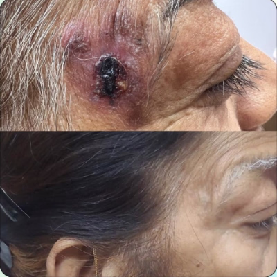 Anti ageing cosmetic care