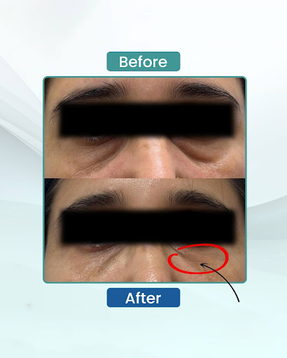 Anti ageing cosmetic care