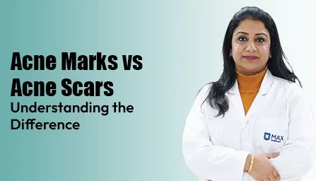 Diabetes and Kidney Failure